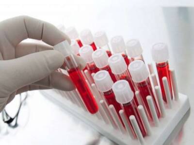 Ученые придумали способ изменить группу крови. Афиша Днепра