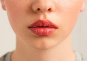 5 методов защитить губы в холода. Афиша Днепра