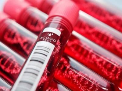 Может ли группа крови влиять на характер человека? Афиша Днепра