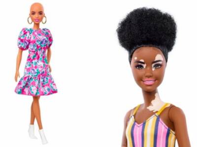 В новой серии Барби появятся куклы без волос и с витилиго. Афиша Днепра