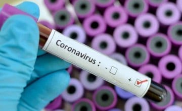 Стали известны даты пика заболеваемости коронавирусом в Украине. Афиша Днепра