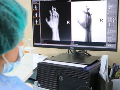 Более 150 снимков в день: в 16-й больнице Днепра заработал новейший цифровой рентген-аппарат. Афиша Днепра